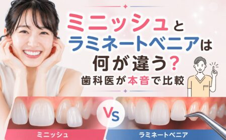 ミニッシュとラミネートベニアは何が違う？