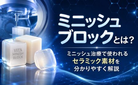 ミニッシュブロック