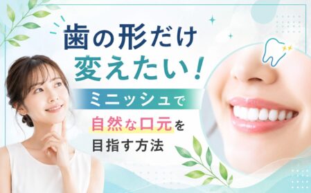 歯の形だけ変えたい！ミニッシュで自然な口元を目指す方法