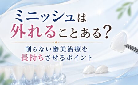 ミニッシュは外れることある？削らない審美治療を長持ちさせるポイント