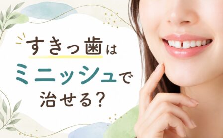 すきっ歯はミニッシュで治せる？適応するケースと注意点