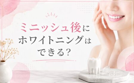ミニッシュ後にホワイトニングはできる？